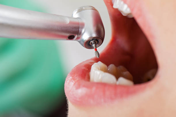 Best Pediatric Emergency Dentist in Pioneer, OH